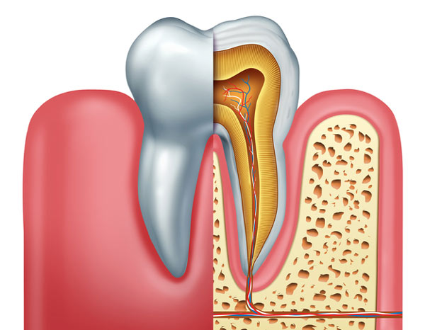 Animated image of root canal tooth