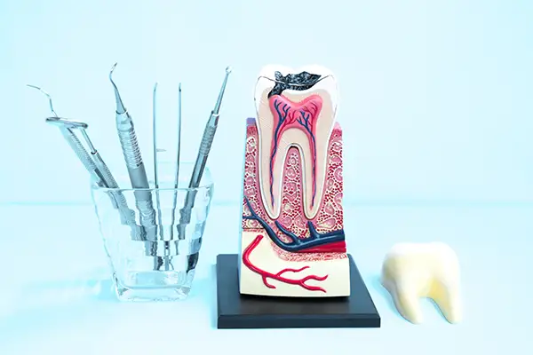 Tooth model displaying internal structure with dental tools used for root canal procedures.